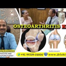 Senior Citizen overcomes Osteoarthritis Knee with Dr. Sachin Lohiya's Acupuncture care