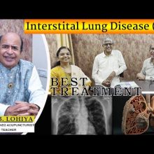 ILD इंटरस्टिशियल लंग डिसीज अर्थात फुप्फुसाचा आजार असलेल्या वृद्ध महिला रुग्णास मिळाले वाढीव जीवनदान